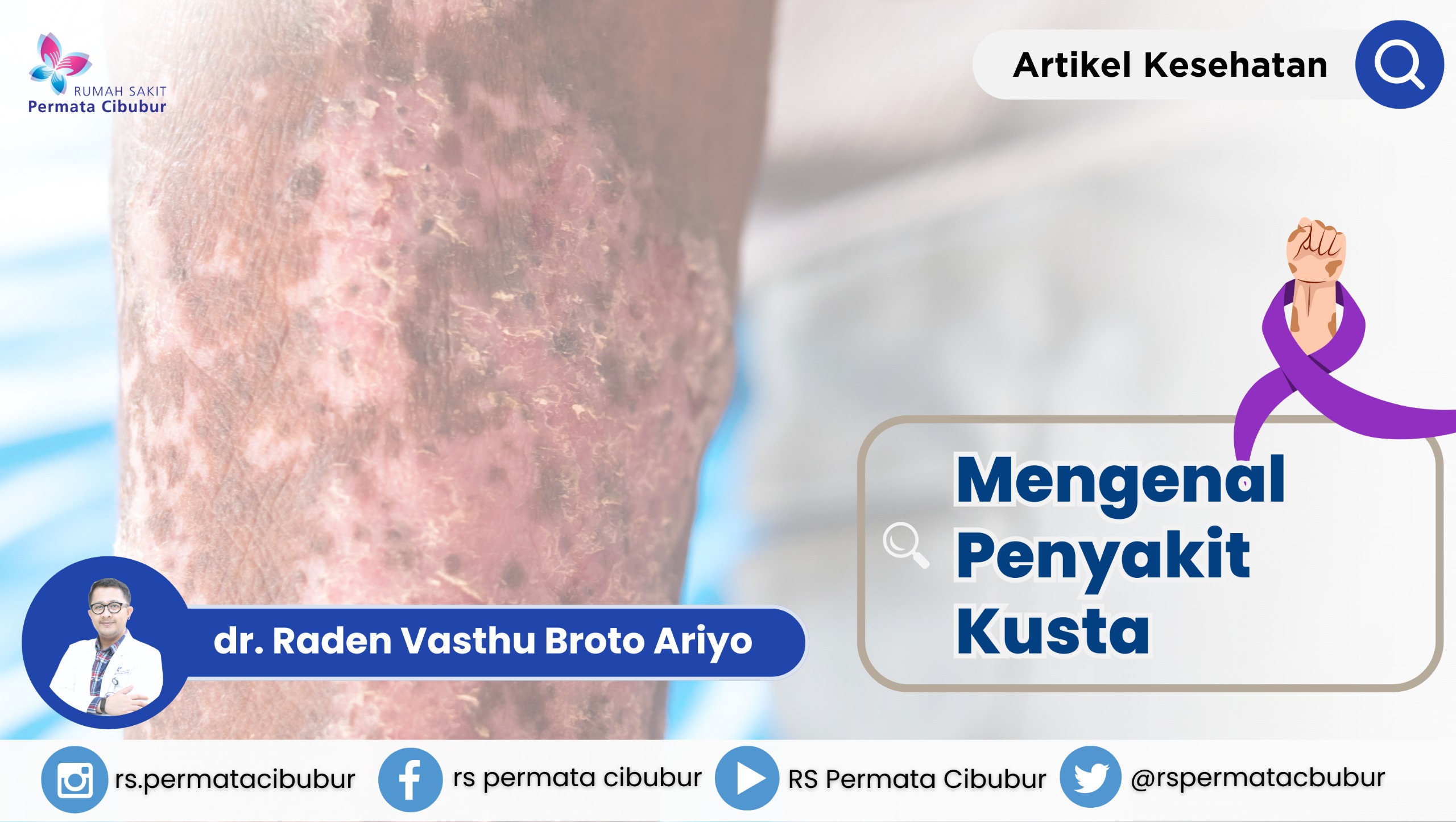 Mengenal Penyakit Kusta